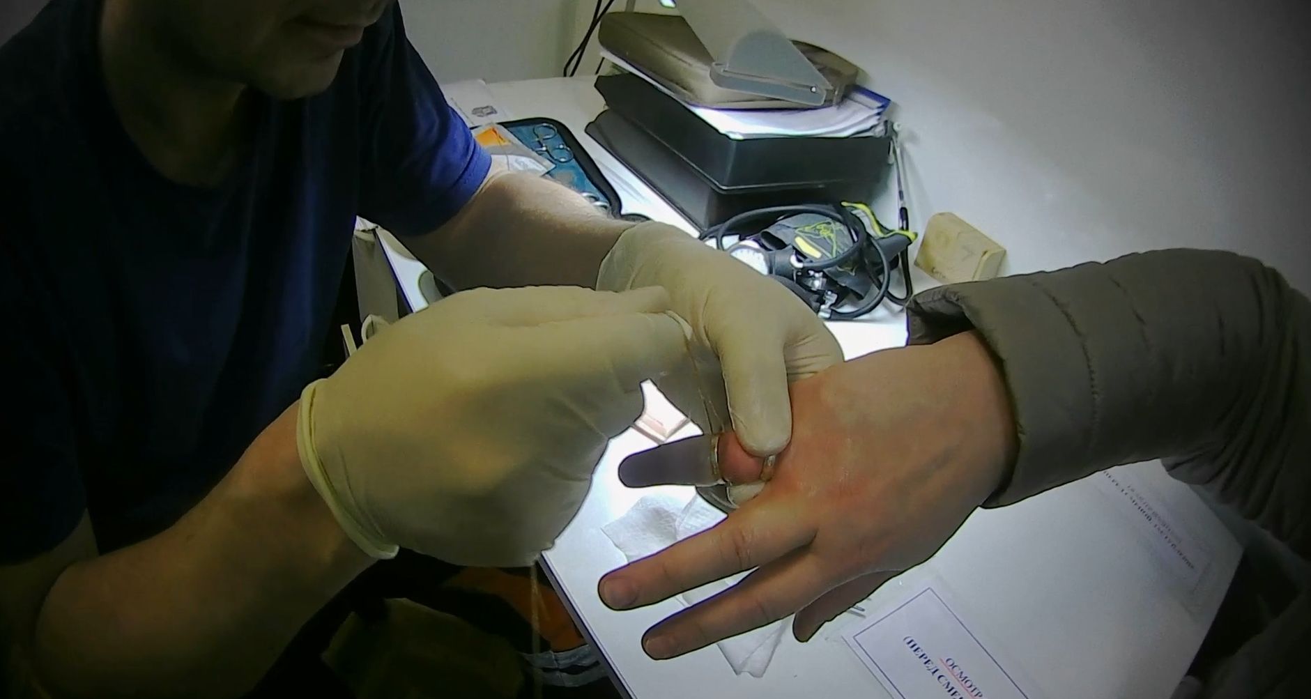 Сотрудники ЦГЗ спасли ярославну от колец, сжавших палец докрасна