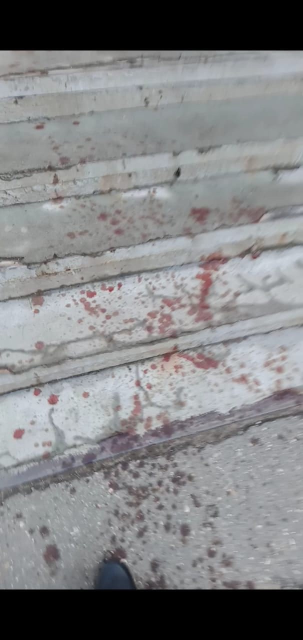 Жителей дома в Ярославле напугал окровавленный подъезд